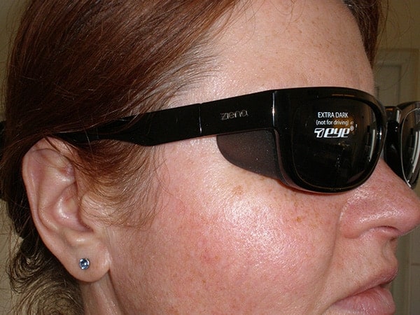 Light sensitivity glasses - Photophobia